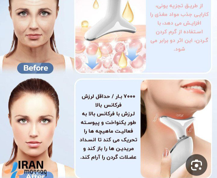ماساژور لیفت گردن و صورت رفع غبغب ES-1081 رنگ قرمز